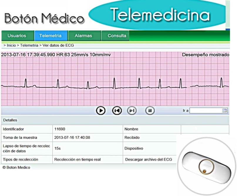 holter telemedicina